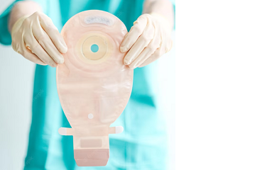 Colocacion y cambio de bolsas de colostomia